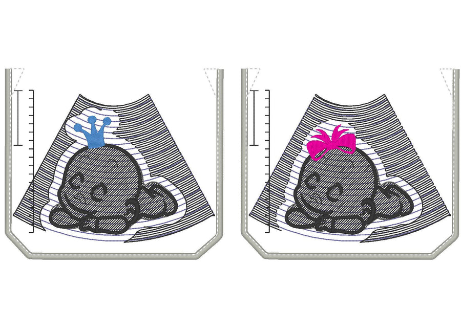 Ultrasound Tech doctor pockets embroidery dsigns Girl and Boy machine