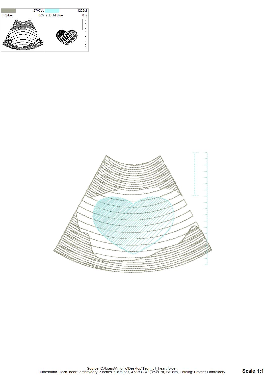 Love Ultrasound Tech Pocket – Appliqué machine embroidery design by Artapli