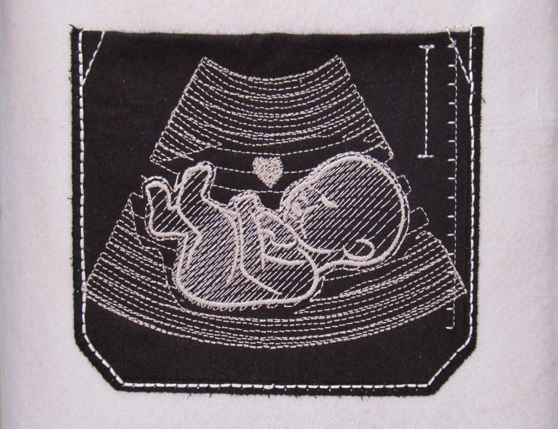 Ultrasound Tech Doctor Pocket With Baby - image 1