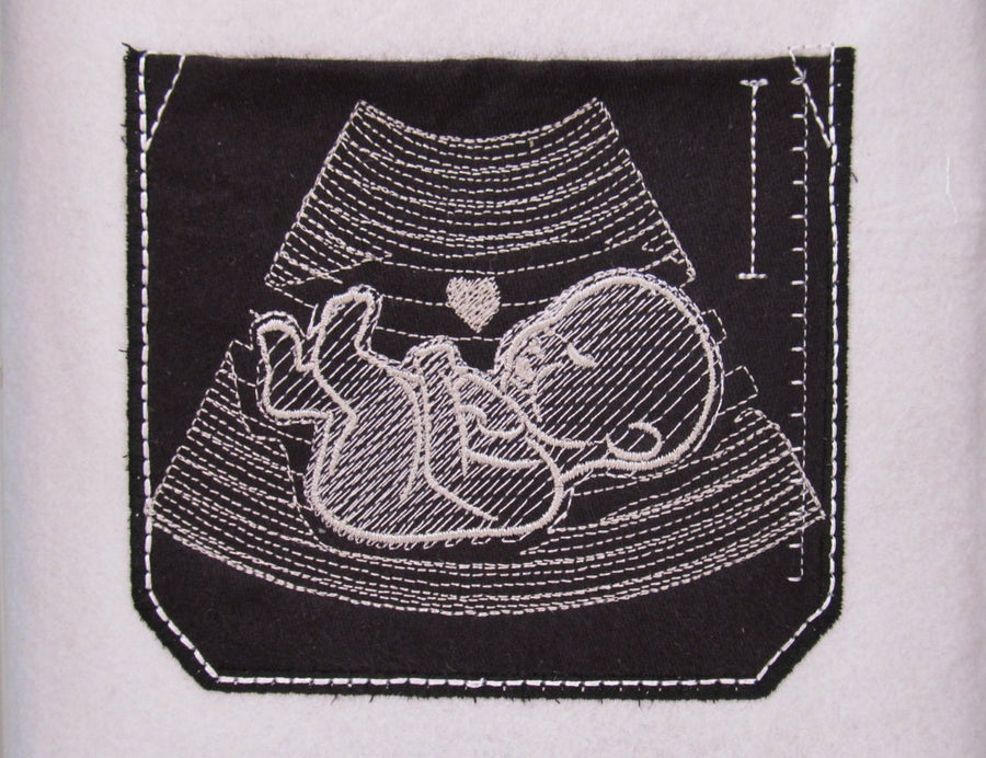 Ultrasound Tech Doctor Pocket With Baby - image 1