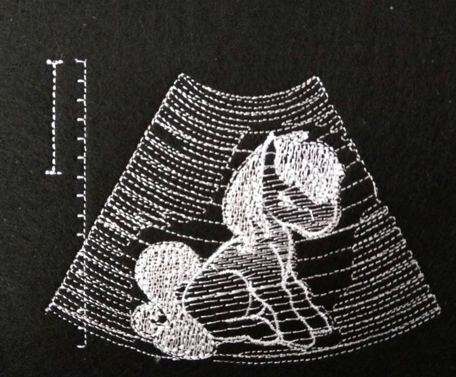 We're hoping it's a pony - Ultrasound Tech pocket Applique Embroidery 4" 4.5" 5" 6" 7" | PES DST JEF | Artapli