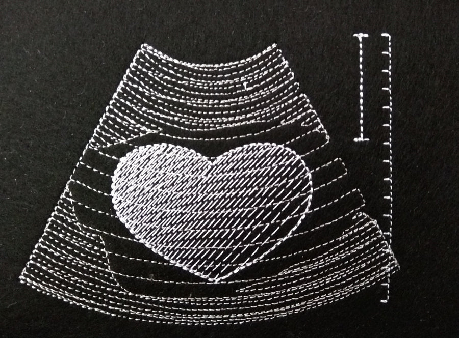 Love Ultrasound Tech Pocket Machine Embroidery 4" 4.5" 5" 6" 7" | PES DST JEF | Artapli